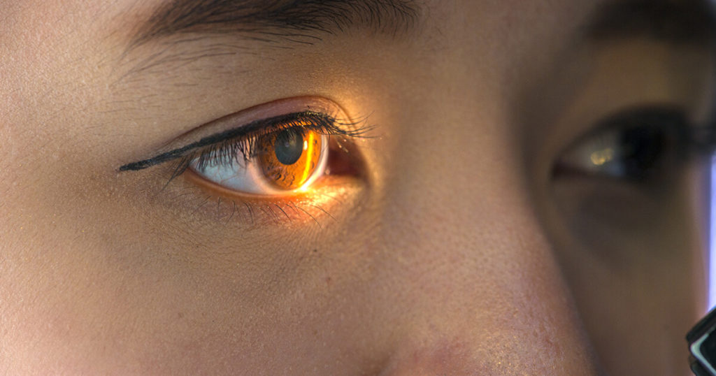 Glaucoma examination